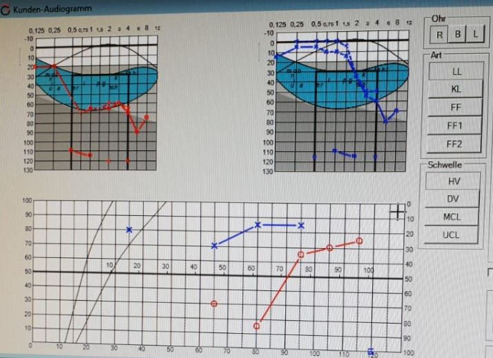 Audiogramm-hermannsc.JPG
