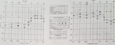 Hörtest in einer &quot;schlecht&quot; hörenden Phase