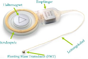 Implantat.JPG