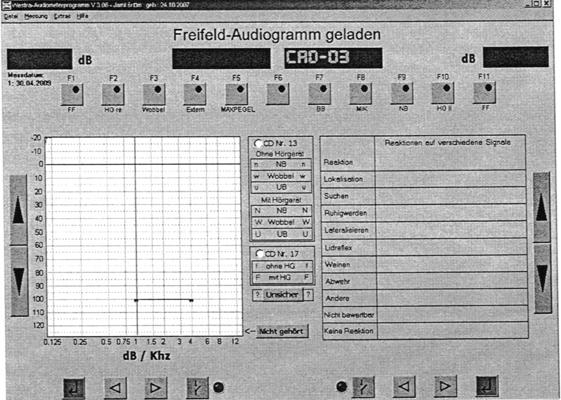Freifeld-Audiogramm.jpg