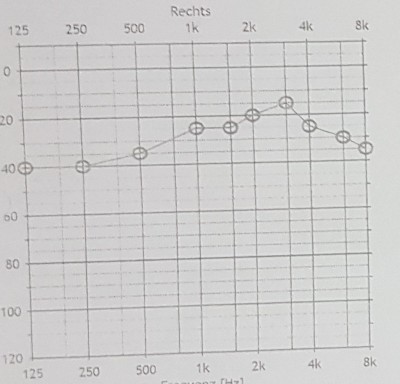 "gut" hörend rechts