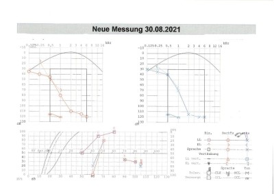 Audiogramm 2021a.jpg