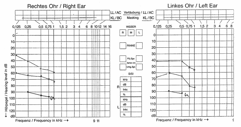 audiogramm10022012.gif