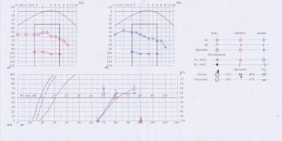 Audiometrie.jpg