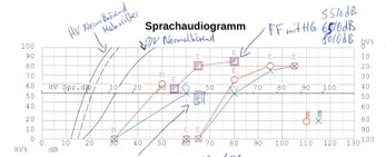 Sprachaudiogramm komplett.jpeg