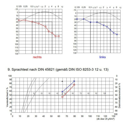 Ergebnis Audiometrie.JPG