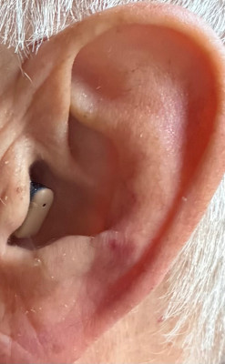 AS mit Titan-Open links