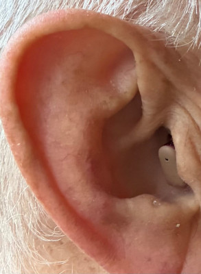 AS mit Titan-Open rechts